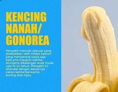 Kencing Nanah Gonore Klinik Penyakit Menular Seksual