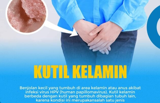 Kutil Kelamin Klinik Penyakit Menular Seksual